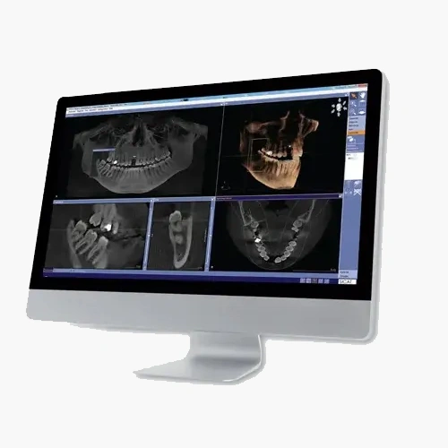 CBCT X-RAYS